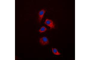 Immunofluorescent analysis of Osteoprotegerin staining in HeLa cells.