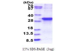 SDS-PAGE (SDS) image for Ankyrin Repeat and SOCS Box Containing 13 (ASB13) (AA 1-278) protein (His tag) (ABIN5853839) (ASB13 Protein (AA 1-278) (His tag))