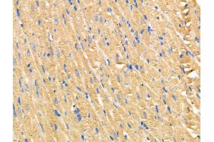 ABIN6258272 and ABIN6274405 at 1/100 staining Rat heart tissue by IHC-P. (MARK2 Antikörper  (Internal Region))