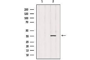 Western blot analysis of extracts from rat heart, using ZADH1 Antibody. (PTGR2 Antikörper  (Internal Region))
