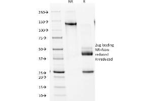 SDS-PAGE Analysis Purified NKX2. (Nkx2-2 Antikörper  (AA 1-119))