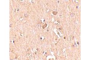 Immunohistochemical staining of human brain tissue with 2. (MED28 Antikörper  (Internal Region))
