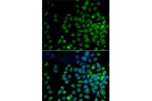 Immunofluorescence analysis of A-549 cells using F/F/UBD antibody (ABIN6131598, ABIN6149778, ABIN6149780 and ABIN6221159). (UBD Antikörper  (AA 1-165))