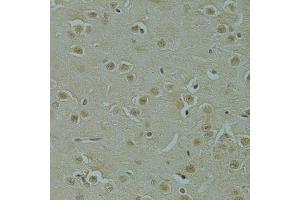 Immunohistochemistry of paraffin-embedded mouse brain using RSRC1 antibody (ABIN5974341) at dilution of 1/100 (40x lens). (RSRC1 Antikörper)