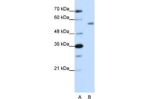 WB Suggested Anti-ZNF497 Antibody Titration:  1. (ZNF497 Antikörper  (N-Term))
