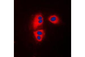 Immunofluorescent analysis of MRPL32 staining in HepG2 cells. (MRPL32 Antikörper  (Center))