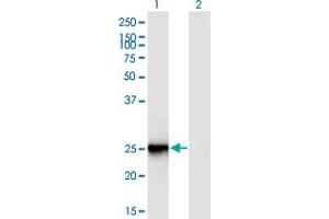 Western Blot analysis of FIGLA expression in transfected 293T cell line by FIGLA monoclonal antibody (M03), clone 6A10. (FIGLA Antikörper  (AA 110-219))