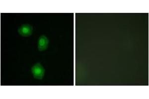 Immunofluorescence analysis of A549 cells, using MSK1 (Ab-376) Antibody. (MSK1 Antikörper  (AA 343-392))