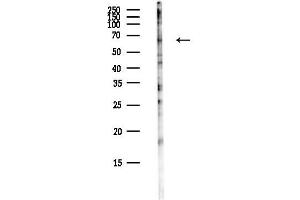 Western blot analysis of lysates from COLO205 cells(heat-shock,45 min treatment), using PL Antibody at 1/1000 dilution.
