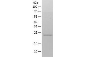 Western Blotting (WB) image for REX2, RNA Exonuclease 2 Homolog (REXO2) (AA 26-237) protein (His tag) (ABIN7124858)