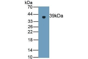 Detection of Recombinant GSDMD, Rat using Polyclonal Antibody to Gasdermin D (GSDMD) (GSDMD Antikörper  (AA 1-326))