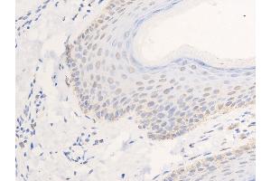 ABIN6267268 at 1/100 staining human skin tissue sections by IHC-P. (EGFR Antikörper  (pSer1026))