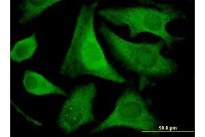 Immunofluorescence (IF) image for anti-Eukaryotic Translation Initiation Factor 2, Subunit 2 Beta, 38kDa (EIF2S2) (AA 1-100) antibody (ABIN522380)