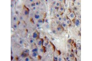 IHC-P analysis of Liver tissue, with DAB staining. (ADAM8 Antikörper  (AA 145-493))