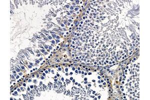 anti-Renin Binding Protein (RENBP) antibody