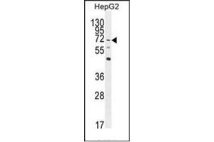 Western blot analysis of LRRC33 Antibody (C-term) in HepG2 cell line lysates (35ug/lane). (LRRC33 Antikörper  (C-Term))