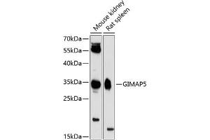 Western blot analysis of extracts of various cell lines, using GIM antibody (ABIN6127954, ABIN6141085, ABIN6141086 and ABIN6224753) at 1:3000 dilution. (GIMAP5 Antikörper  (AA 190-270))
