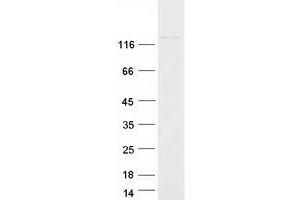 Western Blotting (WB) image for Chromatin Assembly Factor 1, Subunit A (p150) (CHAF1A) protein (Myc-DYKDDDDK Tag) (ABIN2713034)