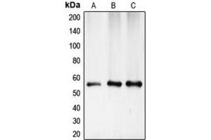 Western blot analysis of CHK1 expression in HeLa (A), mouse kidney (B), rat heart (C) whole cell lysates. (CHEK1 Antikörper  (Center))