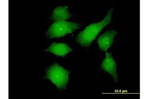 Immunofluorescence of monoclonal antibody to FGFR1OP on HeLa cell. (FGFR1OP Antikörper  (AA 1-379))