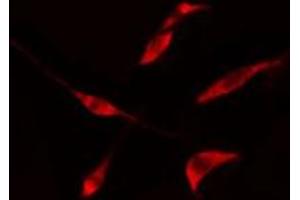 ABIN6275728 staining  LOVO cells by IF/ICC. (THO Complex 4 Antikörper  (Internal Region))
