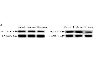 GABA synthesis, uptake and release are impaired in the nucleus accumbens of CUMS-induced depression mice, but not resilience miceThe expression and relative quantity of proteins GAD-67 and VGAT were studied by western-blot. (beta Actin Antikörper)
