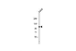 Western Blot at 1:1000 dilution + Jurkat whole cell lysate Lysates/proteins at 20 ug per lane. (PARG Antikörper  (C-Term))