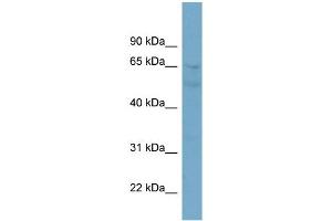 WB Suggested Anti-ZNF671 Antibody Titration:  0. (ZNF671 Antikörper  (N-Term))