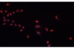 ABIN6266604 staining Daudi cells by IF/ICC. (Oct-2 Antikörper)