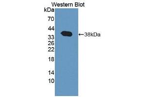 Western blot analysis of the recombinant protein. (TNS3 Antikörper  (AA 1-301))