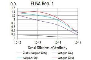 Black line: Control Antigen (100 ng),Purple line: Antigen (10 ng), Blue line: Antigen (50 ng), Red line:Antigen (100 ng) (CCR5 Antikörper)