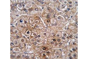 Immunohistochemistry (IHC) image for anti-Bone Morphogenetic Protein Receptor, Type II (serine/threonine Kinase) (BMPR2) (AA 28-59) antibody (ABIN3030192)