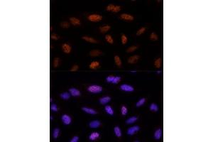 Immunofluorescence analysis of U-2 OS cells using ADNP Polyclonal Antibody (ABIN1678582, ABIN3019032, ABIN3019033 and ABIN6220678) at dilution of 1:100 (40x lens). (ADNP Antikörper  (AA 843-1102))