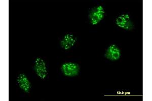 Immunofluorescence of purified MaxPab antibody to USP16 on HeLa cell. (USP16 Antikörper  (AA 1-822))