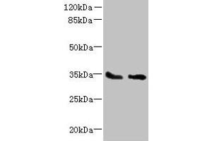 Western blot All lanes: SLC25A36 antibody at 4 μg/mL Lane 1: A431 whole cell lysate Lane 2: A549 whole cell lysate Secondary Goat polyclonal to rabbit IgG at 1/10000 dilution Predicted band size: 35, 15, 18 kDa Observed band size: 35 kDa (SLC25A36 Antikörper  (AA 58-110))