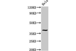 Western Blot Positive WB detected in: Hela whole cell lysate All lanes: DUSP1 antibody at 3. (DUSP1 Antikörper  (AA 125-236))