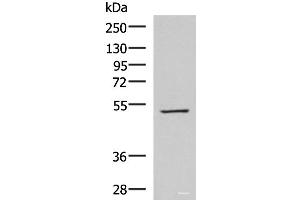 Western blot analysis of HepG2 cell lysate using FDXR Polyclonal Antibody at dilution of 1:1000 (Ferredoxin Reductase Antikörper)