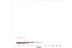 Image no. 2 for anti-Chemokine (C-X-C Motif) Ligand 14 (CXCL14) antibody (ABIN465239) (CXCL14 Antikörper)