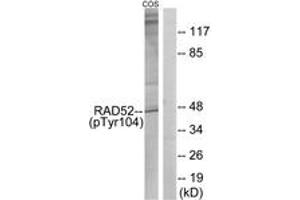 Western blot analysis of extracts from COS7 cells treated with H2O2 100uM 30', using RAD52 (Phospho-Tyr104) Antibody. (RAD52 Antikörper  (pTyr104))