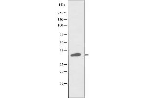 Western blot analysis of extracts from Jurkat cells, using RASD2 antibody. (RASD2 Antikörper  (Internal Region))