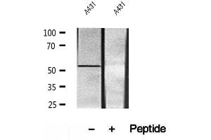 Western blot analysis of extracts of A431 cells, using UBAP1 antibody. (UBAP1 Antikörper)