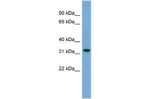 WB Suggested Anti-Gjb3 Antibody Titration: 0. (Connexin 31 Antikörper  (N-Term))