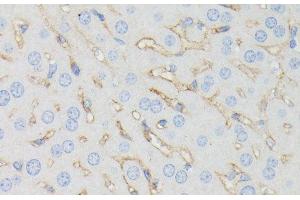 Immunohistochemistry of paraffin-embedded Mouse liver using IFITM1 Polyclonal Antibody at dilution of 1:100 (40x lens). (IFITM1 Antikörper)