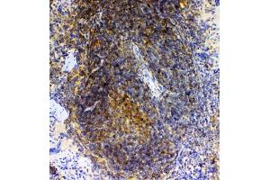 IHC analysis of GRK2 using anti-GRK2 antibody (ABIN5693069). (GRK2 Antikörper)