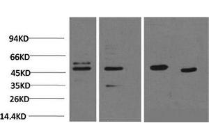 Western Blot analysis of 1) 293T, 2) Jurkat, 3) Rat heart, 4) Mouse heart using Smad3 Monoclonal Antibody at dilution of 1:2000. (SMAD3 Antikörper)