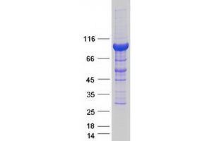 Validation with Western Blot (PDXDC1 Protein (Myc-DYKDDDDK Tag))