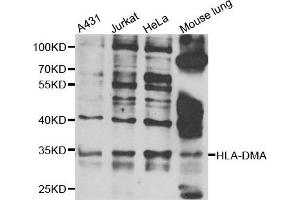 Western blot analysis of extracts of various cell lines, using HLA-DMA antibody. (HLA-DMA Antikörper)