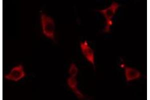 ABIN6275093 staining  Hela cells by IF/ICC. (RNF125 Antikörper  (Internal Region))