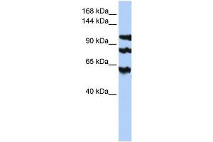 WB Suggested Anti-PPP1R13B  Antibody Titration: 0. (PPP1R13B Antikörper  (Middle Region))