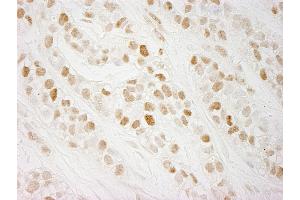 anti-CTF18, Chromosome Transmission Fidelity Factor 18 Homolog (CHTF18) (AA 25-75) antibody